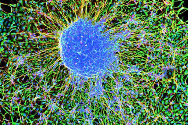 Los científicos revelan las matemáticas ocultas que gobiernan cómo se agrupan las neuronas en el cerebro -Revista Interesante