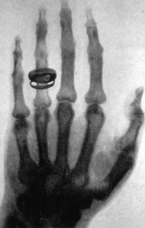 Wilhelm Conrad Röntgen y su descubrimiento revolucionario: los rayos X