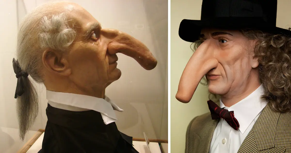 Thomas Wadhouse: "El verdadero Pinocho" que hizo historia con su nariz de 19 cm